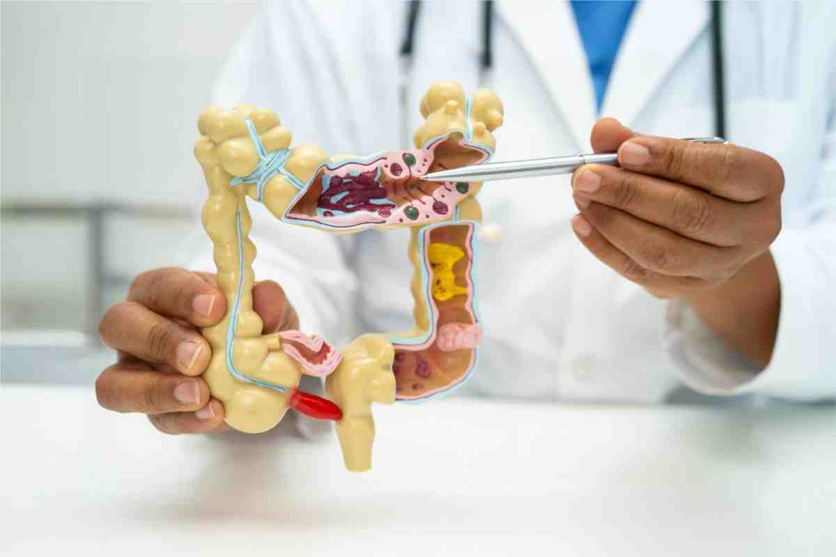 Integrative Perspectives in Ayurvedic Gut Health Management